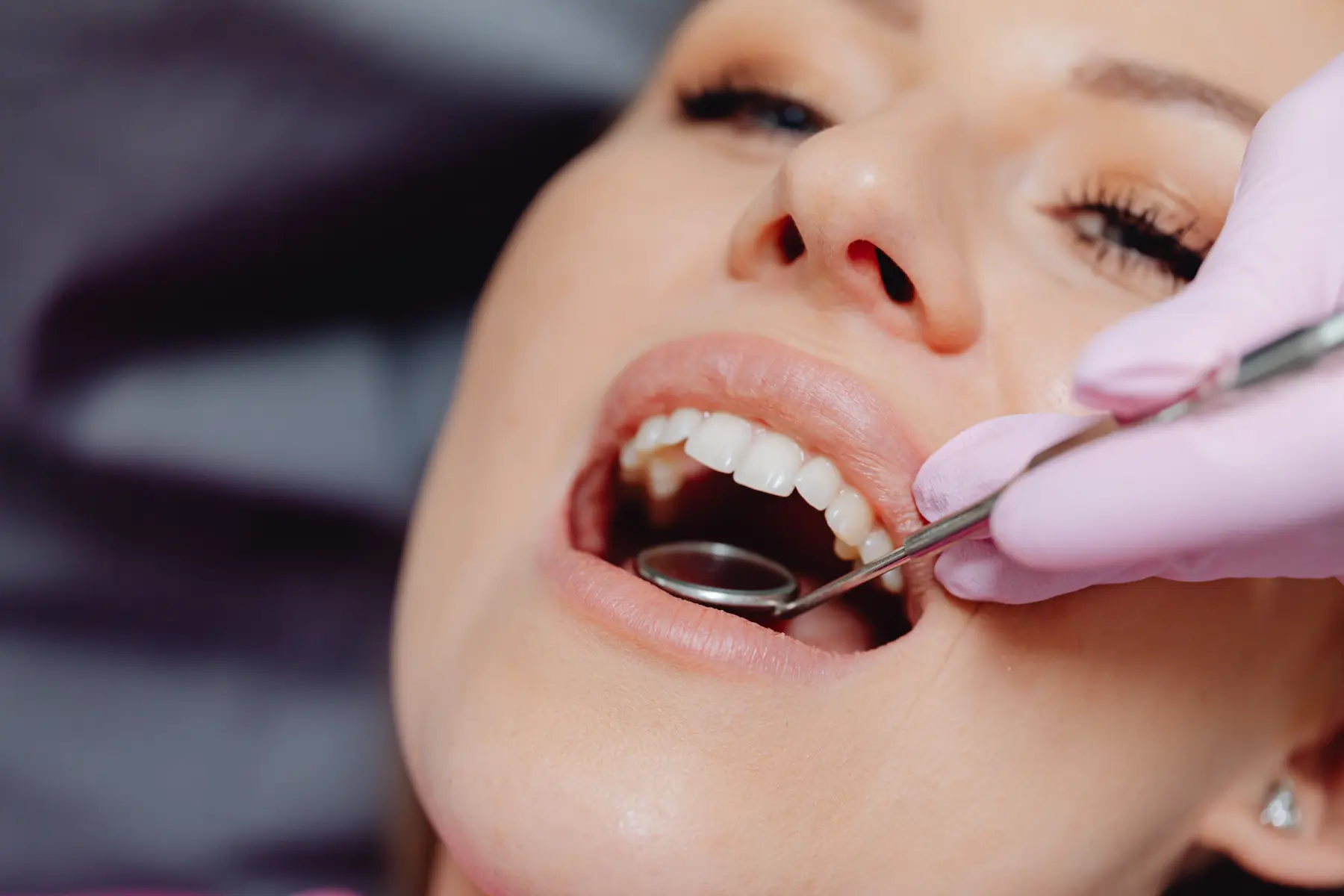 Dental check-up and clean information for Orchard Smiles Dental Surgery in Blackburn North