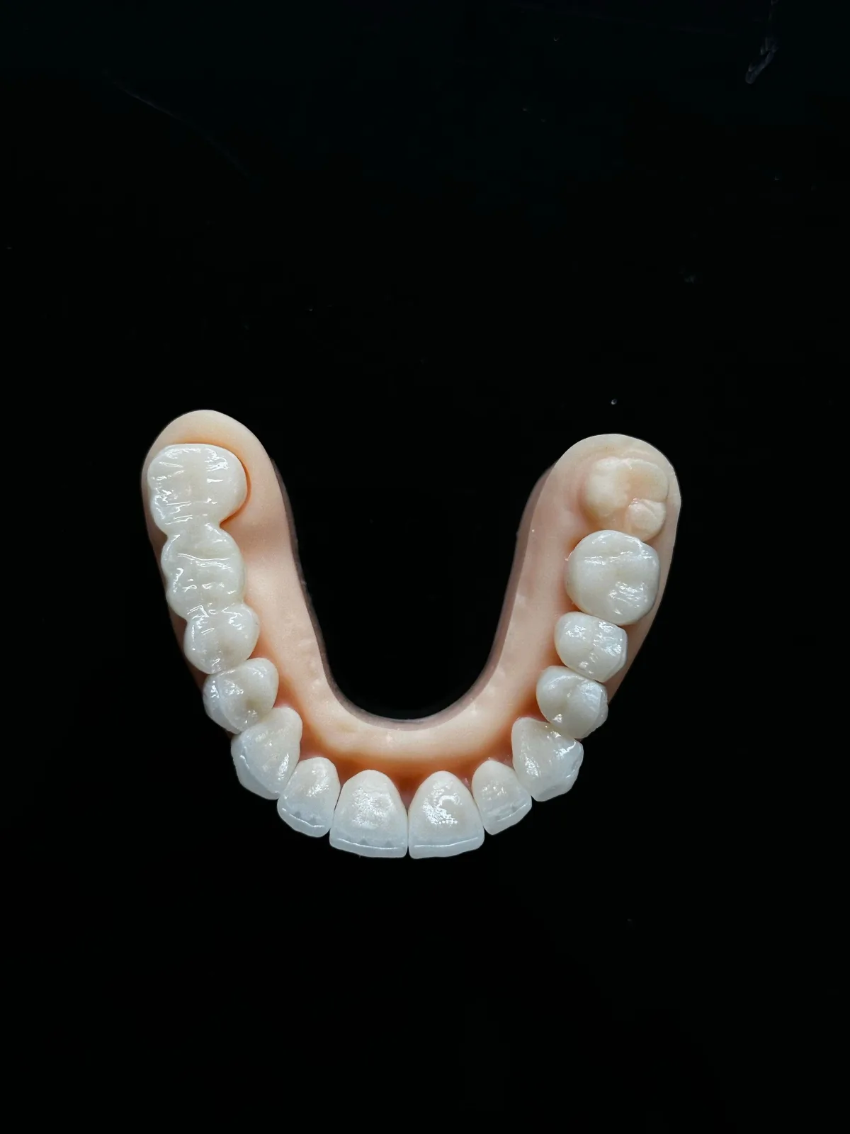 Dental crowns and bridges model for Orchard Smiles patients in Blackburn North