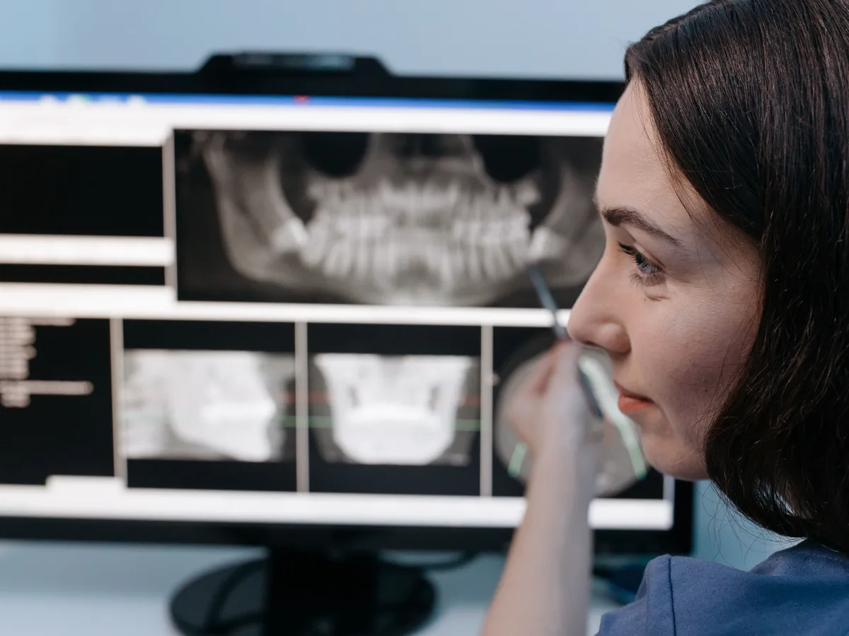 Dental X-ray review used for discussing implant alternatives in Blackburn North