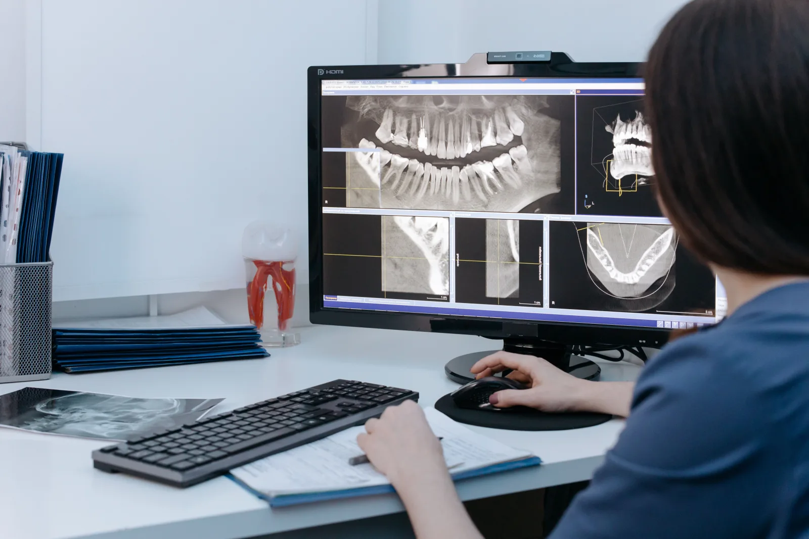 CBCT dental implant planning monitor used for treatment planning information in Blackburn North