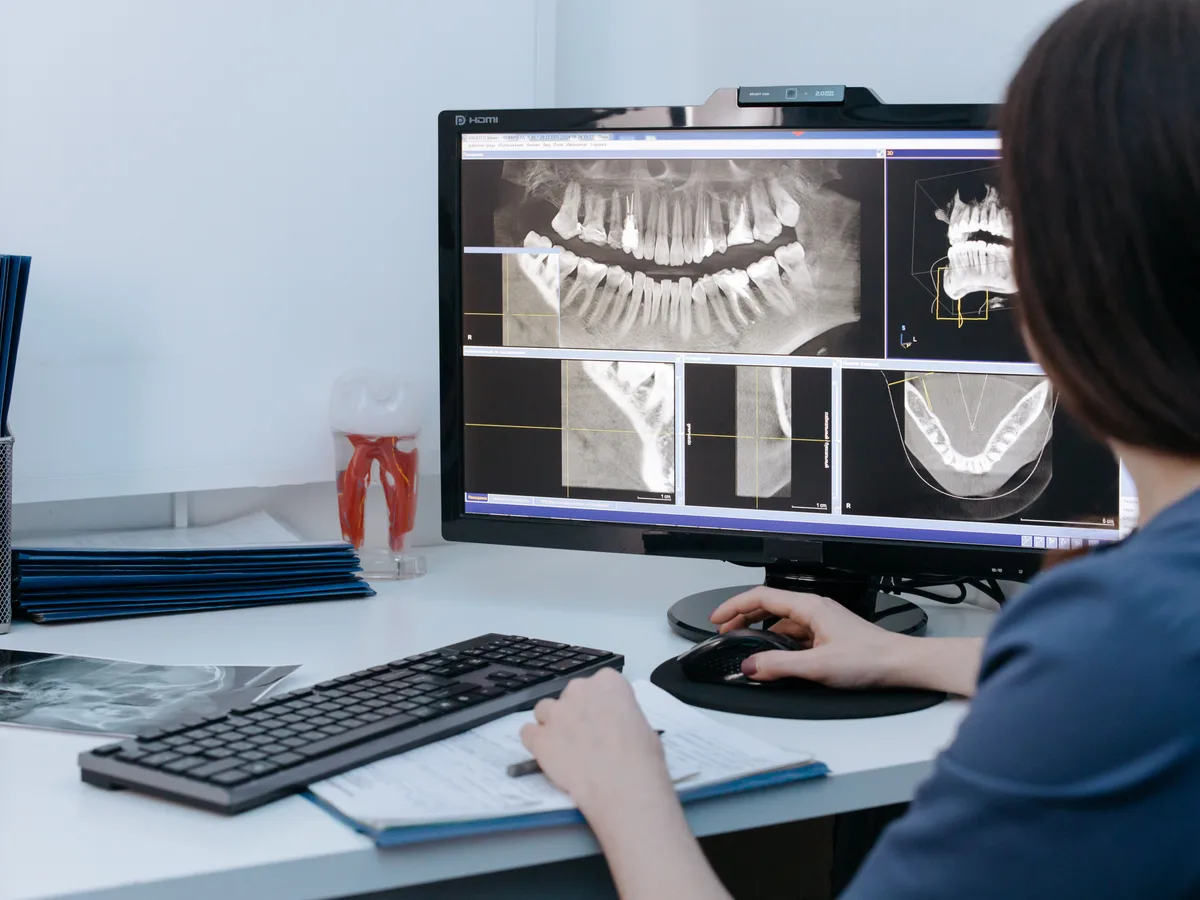 Dental implant planning X-ray monitor used for preparing implant questions in Blackburn North