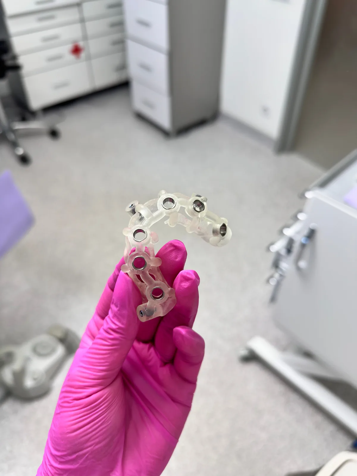 Guided implant surgery splint used for dental implant planning information in Blackburn North